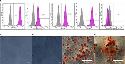 Human Wharton’s Jelly-Derived Mesenchymal Stromal Cells Primed by Tumor Necrosis Factor-α and Interferon-γ Modulate the Innate and Adaptive Immune Cells of Type 1 Diabetic Patients